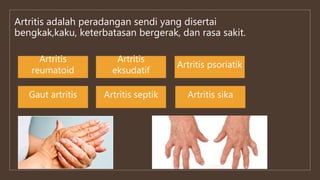 Artritis adalah peradangan sendi yang disertai
bengkak,kaku, keterbatasan bergerak, dan rasa sakit.
Artritis
reumatoid
Gaut artritis
Artritis psoriatik
Artritis sika
Artritis
eksudatif
Artritis septik
 