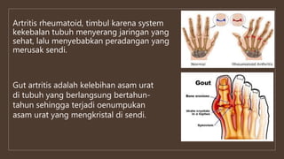 Artritis rheumatoid, timbul karena system
kekebalan tubuh menyerang jaringan yang
sehat, lalu menyebabkan peradangan yang
merusak sendi.
Gut artritis adalah kelebihan asam urat
di tubuh yang berlangsung bertahun-
tahun sehingga terjadi oenumpukan
asam urat yang mengkristal di sendi.
 