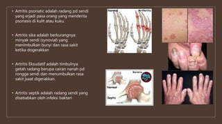 • Artritis psoriatic adalah radang pd sendi
yang erjadi pasa orang yang menderita
psoriasis di kulit atau kuku.
• Artritis sika adalah berkurangnya
minyak sendi (synovial) yang
menimbulkan bunyi dan rasa sakit
ketika dogerakkan
• Artritis Eksudatif adalah timbulnya
getah radang berupa cairan nanah pd
rongga sendi dan menumbulkan rasa
sakit jsaat digerakkan.
• Artritis septik adalah radang sendi yang
disebabkan oleh infeksi bakteri
 