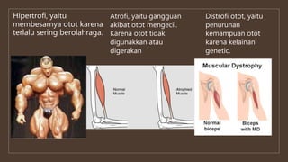 Hipertrofi, yaitu
membesarnya otot karena
terlalu sering berolahraga.
Atrofi, yaitu gangguan
akibat otot mengecil.
Karena otot tidak
digunakkan atau
digerakan
Distrofi otot, yaitu
penurunan
kemampuan otot
karena kelainan
genetic.
 