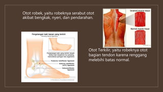 Otot robek, yaitu robeknya serabut otot
akibat bengkak, nyeri, dan pendarahan.
Otot Terkilir, yaitu robeknya otot
bagian tendon karena renggang
melebihi batas normal.
 