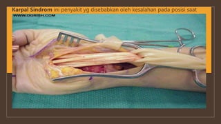 Karpal Sindrom ini penyakit yg disebabkan oleh kesalahan pada posisi saat
memegang mouse.
Karpal Sindrome :
1. Lebih sering terjadi pada wanita, dengan perbandingan 3 : 1.
2. Usia terjadinya penyakit ini terutama antara 30-60 tahun.
3. Pertambahan usia dapat memperbesar risiko terjadinya Karpal Sindrome.
4. Selain pekerjaan, KS terjadi akibat kondisi medis,seperti rematik, hipotiroid,
kehamilan, asam urat, diabetes, tumor.
 