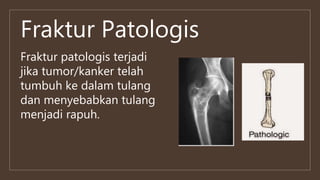 Fraktur Patologis
Fraktur patologis terjadi
jika tumor/kanker telah
tumbuh ke dalam tulang
dan menyebabkan tulang
menjadi rapuh.
 