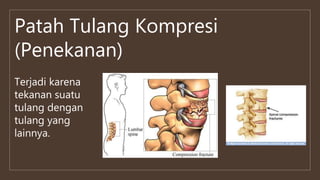 Patah Tulang Kompresi
(Penekanan)
Terjadi karena
tekanan suatu
tulang dengan
tulang yang
lainnya.
 