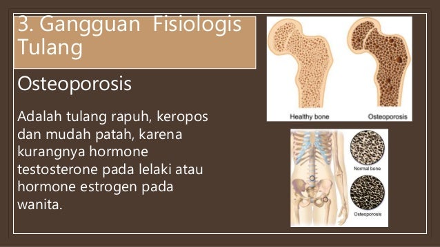 Gangguan pada sistem gerak.