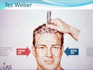 Tes Weber
 