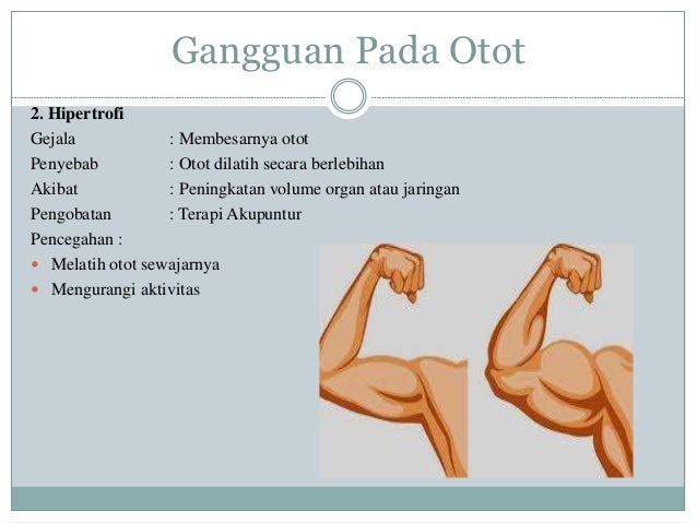 Gangguan sistem gerak