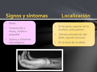 • Dolor.
                      • En la parte superior de la
• Tumoración o
                        muñeca ,lado palmar .
  masa, visible o
  palpable.           •   Última articulación del
                          dedo, (quiste mucoso).
• Signos y síntomas
  neurológicos.       • En la base de un dedo.
 