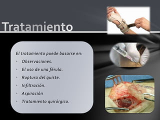 El tratamiento puede basarse en:
• Observaciones.
• El uso de una férula.
• Ruptura del quiste.
• Infiltración.
• Aspiración
• Tratamiento quirúrgico.
 