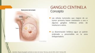GANGLIO CENTINELA
Concepto
 Las células tumorales que migran de un
tumor primario hacen metástasis a uno o
algunos ganglios linfáticos antes de
involucrar a otros.
 La diseminación linfática sigue un patrón
ordenado y prescindible en la zona
linfoportadora.
Uptodate, Biopsia de ganglio centinela en cáncer de mama: Técnicas, julio de 2021, Seth P. Harlow, MD
 