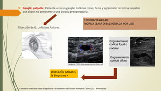  Ganglio palpable: Pacientes con un ganglio linfático móvil, firme y agrandado de forma palpable
que eligen no someterse a una biopsia preoperatoria:
Disección de G. Linfáticos Axilares.
ECOGRAFIA AXILAR:
BIOPSIA (BAAF O BAG) GUIADA POR USG
DISECCIÓN AXILAR si
la Biopsia es +
Consenso Mexicano sobre diagnóstico y tratamiento del cáncer mamario Colima 2021 Novena rev.
 