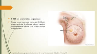 3. DCIS con características sospechosas:
 Cirugía conservadora de mama por DCIS con
sospecha clínica de albergar cáncer invasivo,
incluido DCIS de más de 5 cm y DCIS con una
masa palpable.
Uptodate, Biopsia de ganglio centinela en cáncer de mama: Técnicas, julio de 2021, Seth P. Harlow, MD
 