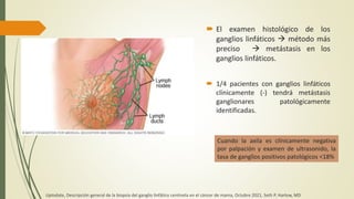  El examen histológico de los
ganglios linfáticos  método más
preciso  metástasis en los
ganglios linfáticos.
 1/4 pacientes con ganglios linfáticos
clínicamente (-) tendrá metástasis
ganglionares patológicamente
identificadas.
Cuando la axila es clínicamente negativa
por palpación y examen de ultrasonido, la
tasa de ganglios positivos patológicos <18%
Uptodate, Descripción general de la biopsia del ganglio linfático centinela en el cáncer de mama, Octubre 2021, Seth P. Harlow, MD
 