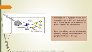  Comienza con la inyección de uno o dos
marcadores en la piel o el parénquima
de la mama, ya sea en la vecinidad del
tumor o debajo del plexo areolar.
 Estos marcadores ingresan a los canales
linfáticos y fluyen pasivamente hacia los
ganglios linfáticos de drenaje.
Uptodate, Biopsia de ganglio centinela en cáncer de mama: Técnicas, julio de 2021, Seth P. Harlow, MD
 