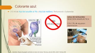 Colorante azul:
 3-5 ml de Azul de isosulfán al 1% o Azul de metileno. Peritumoral o Subareolar.
No
intratumoral
AZUL DE ISOSULFAN:
REACCION ANAFILÁCTICA
0.16-1.1%  requieren
reanimación
Uptodate, Biopsia de ganglio centinela en cáncer de mama: Técnicas, julio de 2021, Seth P. Harlow, MD
 