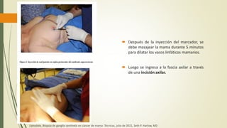  Después de la inyección del marcador, se
debe masajear la mama durante 5 minutos
para dilatar los vasos linfáticos mamarios.
 Luego se ingresa a la fascia axilar a través
de una incisión axilar.
Uptodate, Biopsia de ganglio centinela en cáncer de mama: Técnicas, julio de 2021, Seth P. Harlow, MD
 