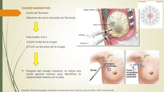 COLOIDE RADIOACTIVO:
- Azufre de Tecnecio
- Albumina de suero marcada con Tecnecio.
- Vida media: 6 hrs.
- 0.5mCi el día de la cirugía
- 2.5 mCi un día antes de la cirugía
 Después del masaje mamario, se utiliza una
sonda gamma manual para identificar la
radiactividad máxima en la axila.
Uptodate, Biopsia de ganglio centinela en cáncer de mama: Técnicas, julio de 2021, Seth P. Harlow, MD
 