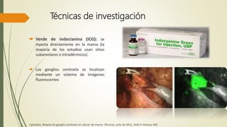 Técnicas de investigación
 Verde de indocianina (ICG): se
inyecta directamente en la mama (la
mayoría de los estudios usan sitios
subareolares o intradérmicos).
 Los ganglios centinela se localizan
mediante un sistema de imágenes
fluorescentes
Uptodate, Biopsia de ganglio centinela en cáncer de mama: Técnicas, julio de 2021, Seth P. Harlow, MD
 