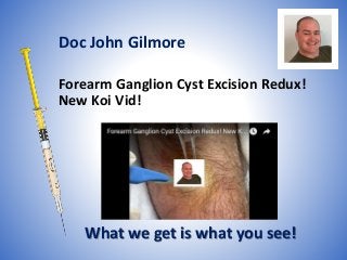 Forearm Ganglion Cyst Excision Redux!
New Koi Vid!
What we get is what you see!
Doc John Gilmore
 