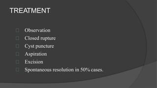 TREATMENT
Observation
Closed rupture
Cyst puncture
Aspiration
Excision
Spontaneous resolution in 50% cases.
 