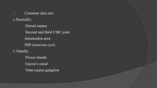 Common sites are:
a.Dosrsally:
Dorsal carpus
Second and third CMC joint
Intratendon area
DIP (muscous cyst)
b.Volarlly:
Flexor sheath
Guyon’s canal
Volar carpus ganglion
 