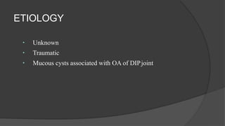 ETIOLOGY
Unknown
Traumatic
Mucous cysts associated with OA of DIPjoint
 