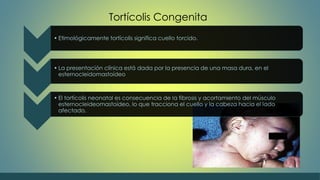 Tortícolis Congenita 
• Etimológicamente tortícolis significa cuello torcido. 
• La presentación clínica está dada por la presencia de una masa dura, en el 
esternocleidomastoídeo 
• El tortícolis neonatal es consecuencia de la fibrosis y acortamiento del músculo 
esternocleideomastoídeo, lo que tracciona el cuello y la cabeza hacia el lado 
afectado. 
 