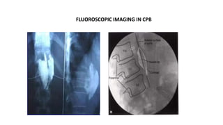 FLUOROSCOPIC IMAGING IN CPB
 