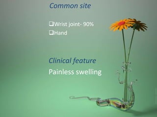 Common site
Wrist joint- 90%
Hand
Clinical feature
Painless swelling