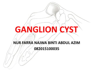 GANGLION CYST
NUR FARRA NAJWA BINTI ABDUL AZIM
082015100035
 