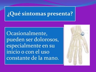 ¿Qué síntomas presenta?


Ocasionalmente,
pueden ser dolorosos,
especialmente en su
inicio o con el uso
constante de la mano.
 