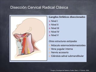 Disección Cervical Radical Clásica
Cirugía y Oncología de Cabeza y Cuello. Shah,J. 3º Edición. 2004.
 
