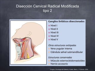 Disección Cervical Radical Modificada
tipo 2
Cirugía y Oncología de Cabeza y Cuello. Shah,J. 3º Edición. 2004.
 