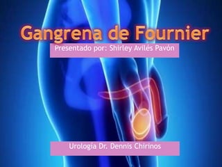 Presentado por: Shirley Avilés Pavón
Urología Dr. Dennis Chirinos
 