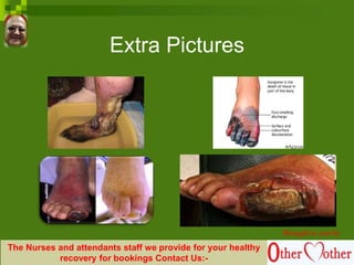 Extra Pictures
Brought to you by
The Nurses and attendants staff we provide for your healthy
recovery for bookings Contact Us:-
 