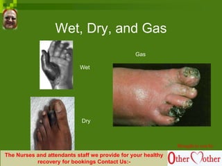 Wet, Dry, and Gas
Wet
Dry
Gas
Brought to you by
The Nurses and attendants staff we provide for your healthy
recovery for bookings Contact Us:-
 