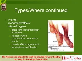Types/Where continued
 Internal
Gangrene=affects
internal organs
1. Blood flow to internal organ
is blocked
2. Happens when
complications occur with a
hernia
3. Usually affects organs such
as intestines, gallbladder,
or appendix.
Brought to you by
The Nurses and attendants staff we provide for your healthy
recovery for bookings Contact Us:-
 