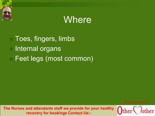 Where
 Toes, fingers, limbs
 Internal organs
 Feet legs (most common)
Brought to you by
The Nurses and attendants staff we provide for your healthy
recovery for bookings Contact Us:-
 
