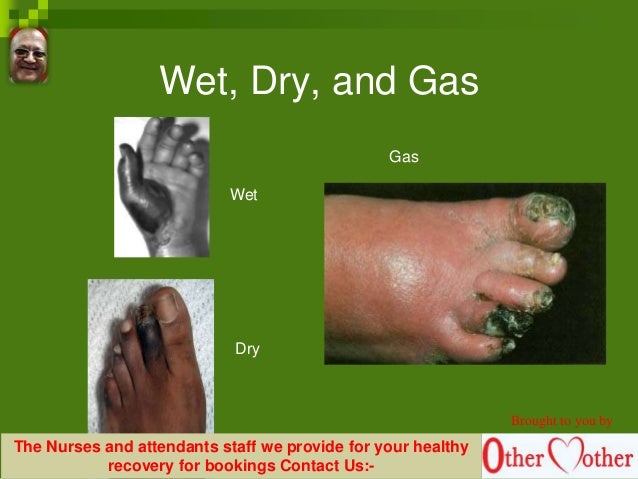 Gangrene