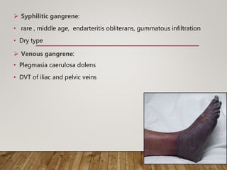  Syphilitic gangrene:
• rare , middle age, endarteritis obliterans, gummatous infiltration
• Dry type
 Venous gangrene:
• Plegmasia caerulosa dolens
• DVT of iliac and pelvic veins
 