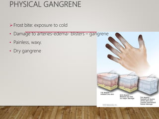PHYSICAL GANGRENE
Frost bite: exposure to cold
• Damage to arteries-edema- blisters – gangrene
• Painless, waxy.
• Dry gangrene
 