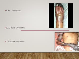 BURNS GANGRENE:
ELECTRICAL GANGRENE:
CORROSIVE GANGRENE:
 