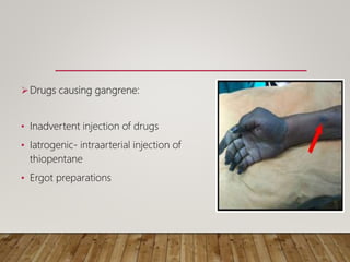Drugs causing gangrene:
• Inadvertent injection of drugs
• Iatrogenic- intraarterial injection of
thiopentane
• Ergot preparations
 