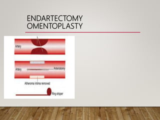 ENDARTECTOMY
OMENTOPLASTY
 
