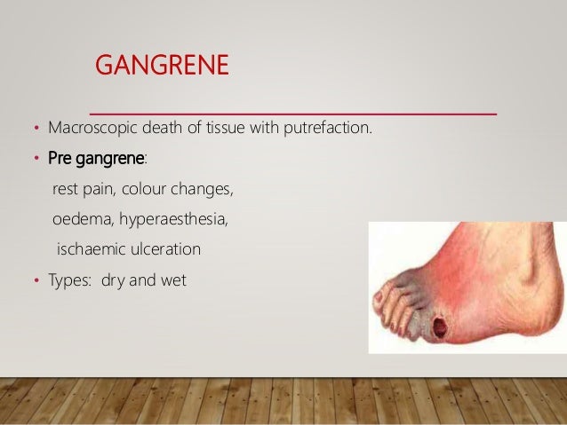 Gangrene