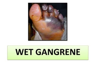 WET GANGRENE
 