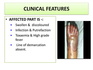 CLINICAL FEATURES
• AFFECTED PART IS -:
• Swollen & discoloured
• Infection & Putrefaction
• Toxaemia & High grade
fever
• Line of demarcation
absent.
 