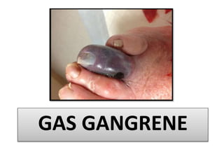 GAS GANGRENE
 