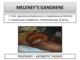MELENEY’S GANGRENE
 Post –operative streptococcal or staphylococcal infection
 Involves skin of abdomen →Inflammed app. & Gb op
TREATMENT – ANTIBIOTIC THERAPY
 
