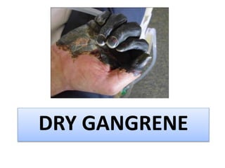 DRY GANGRENE
 